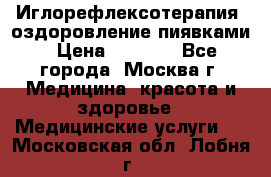 Иглорефлексотерапия, оздоровление пиявками › Цена ­ 3 000 - Все города, Москва г. Медицина, красота и здоровье » Медицинские услуги   . Московская обл.,Лобня г.